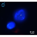 Protoperidinium subinerme