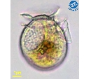 Dinophysis ovum