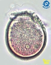 Dinophysis ovum