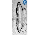 Hantzschia amphioxys