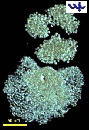 Microcystis flos aqua