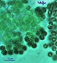 Microcystis flos aqua