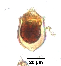 Acanthostomella norvegica