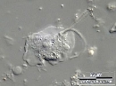 Platyamoeba