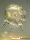 Arcella gibbosa