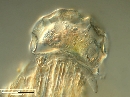 Arcella gibbosa