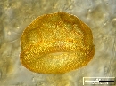 Arcella gibbosa