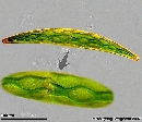 Closterium striolatum