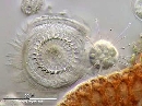 Trichodina pediculus